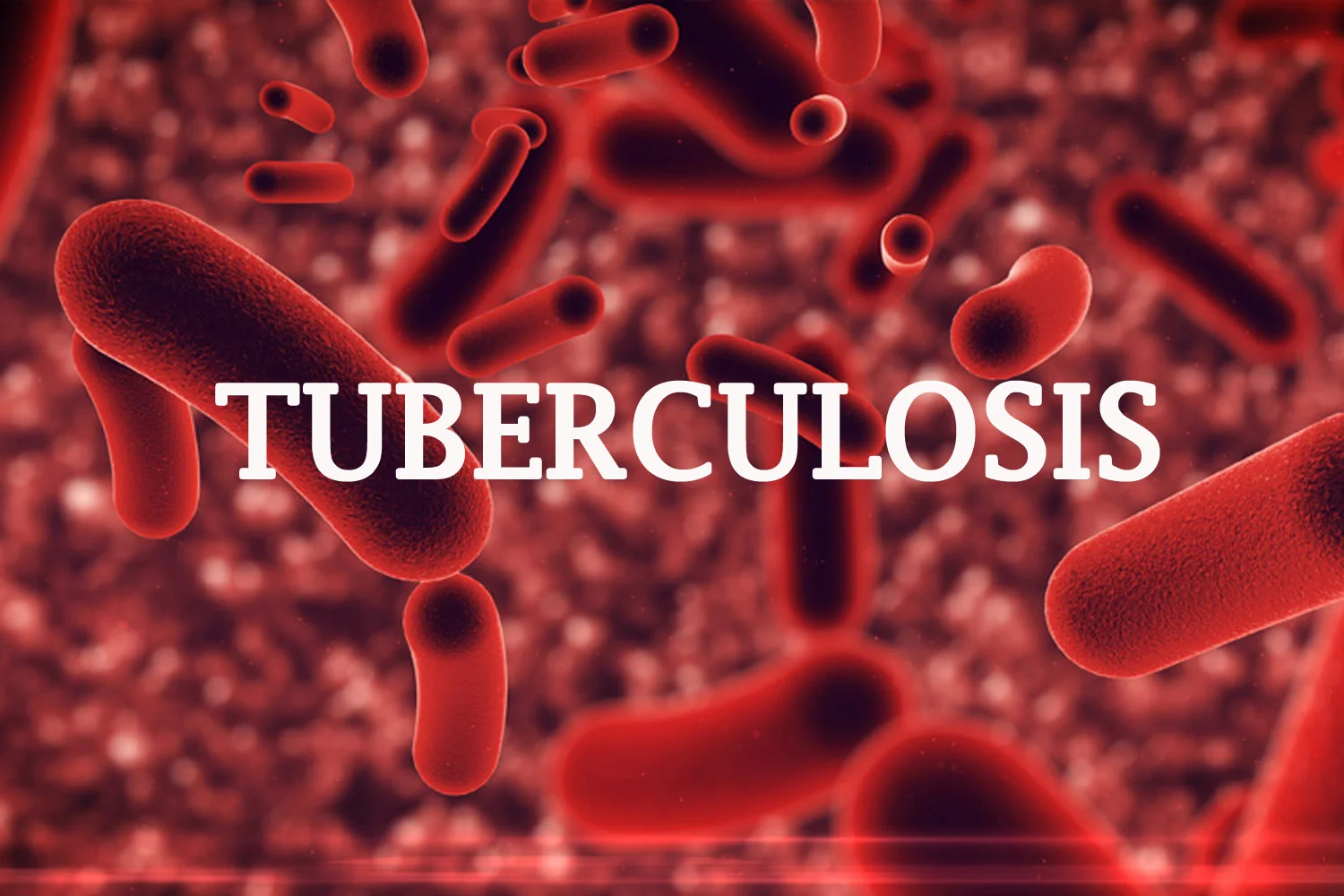 Tuberculosis: Institute raises alarm over high rate of death in Ogun