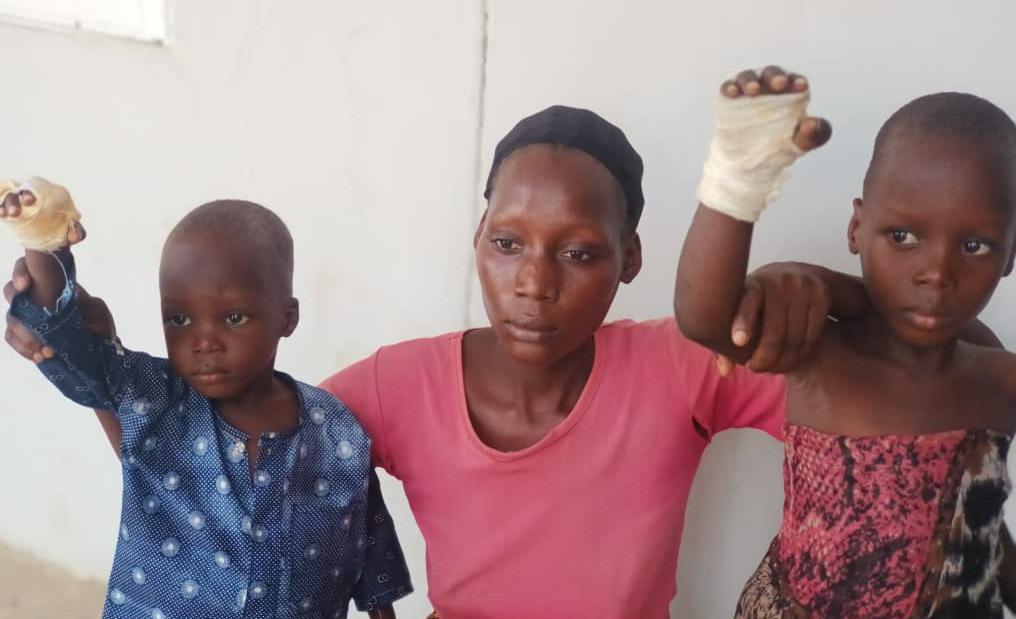 Woman, 23, burns stepchildren’s hands over plate of rice